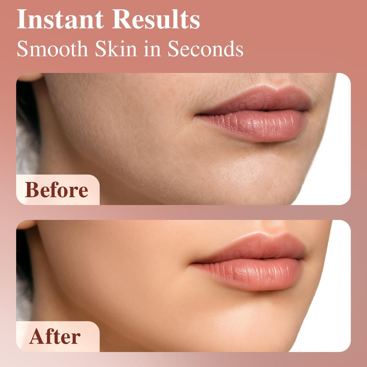 Facial Hair Removal for Women M7770